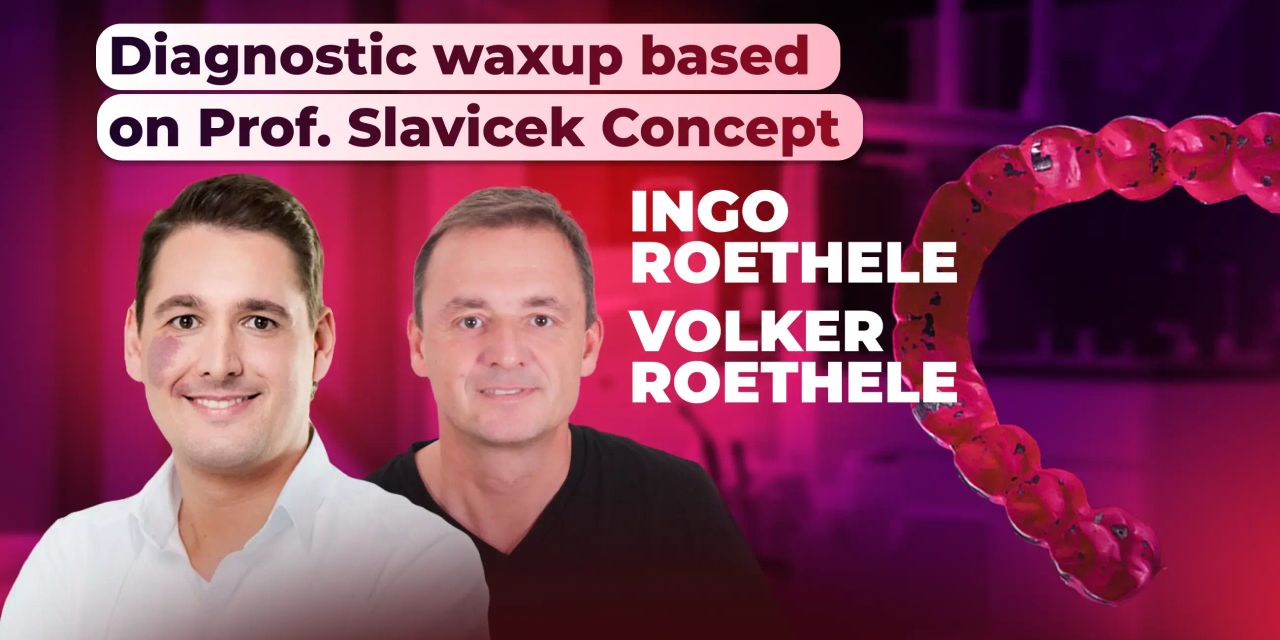 Diagnostic Wax-up in the Concept of Dr. Slavicek – OHI-S course banner