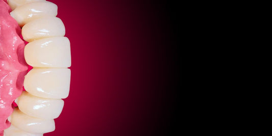 Full-Arch Rehabilitation: Implantation and Prosthetics – OHI-S course banner