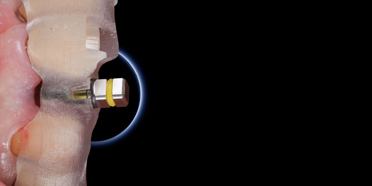 Implant Placement in the Aesthetic Zone: Steps and Techniques – OHI-S course banner