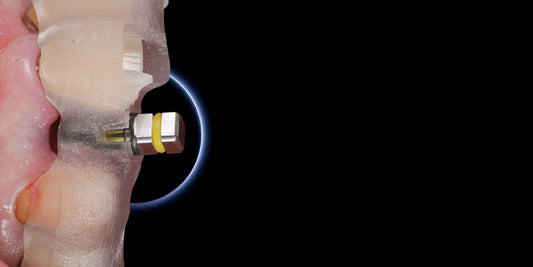 Implant Placement in the Aesthetic Zone: Steps and Techniques – OHI-S course banner