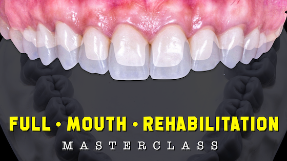 FMR Masterclass – MIK Education full mouth rehabilitation course by Dr. Moez Khakiani