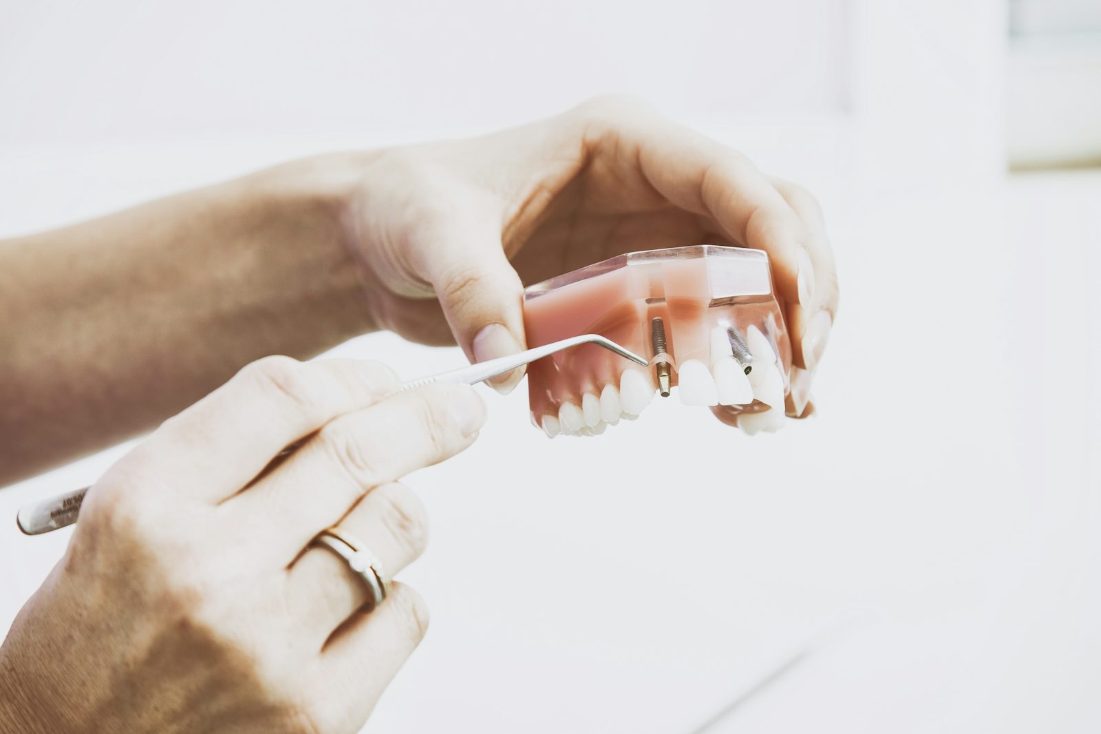 Hands holding a dental model – stock photo (Unsplash)