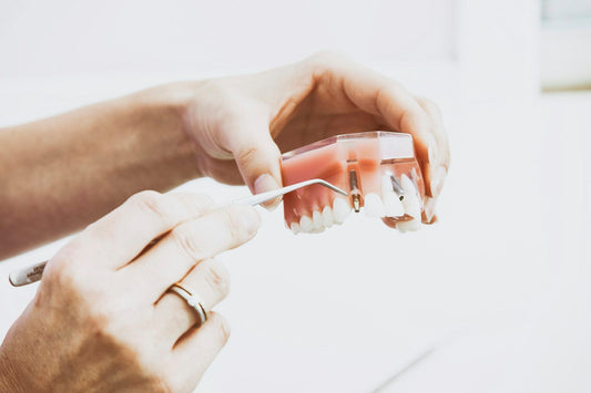 Hands holding a dental model – stock photo (Unsplash)