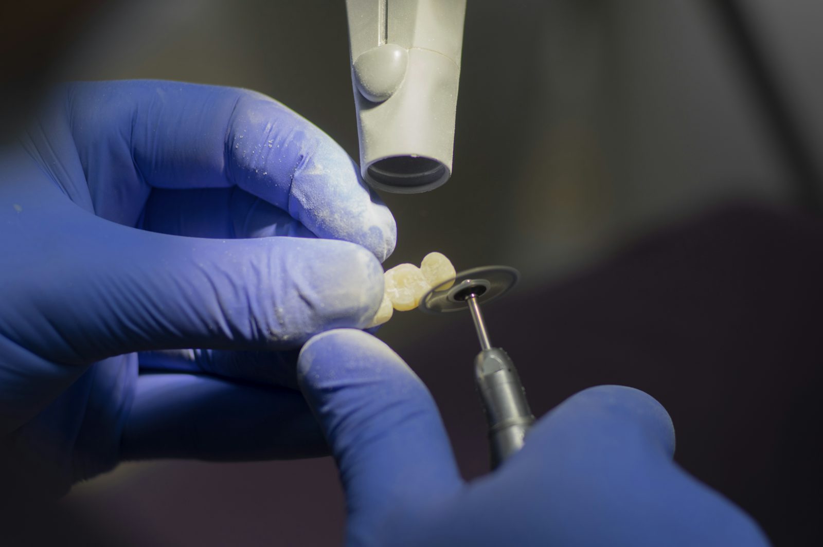 Aesthetic medicine injection tools – stock photo (Unsplash)