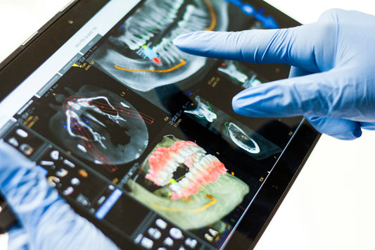 Dental CAD model design – stock photo (Unsplash)