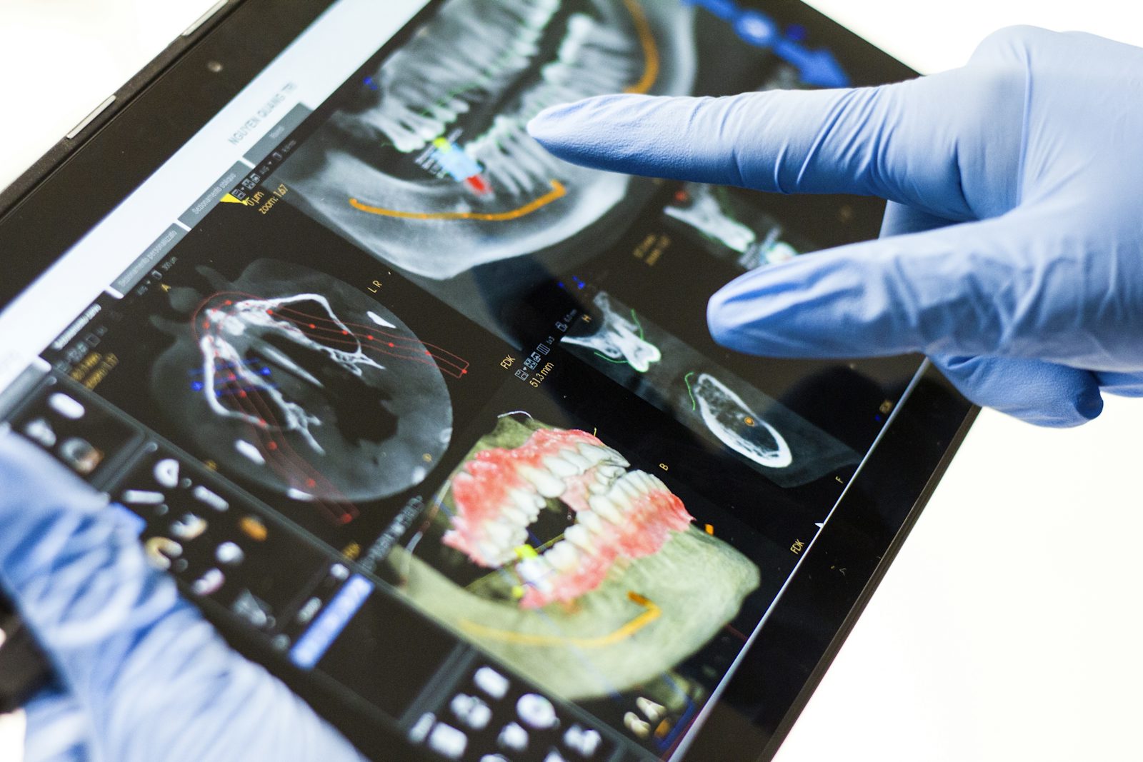 Dental model – stock photo (Unsplash)