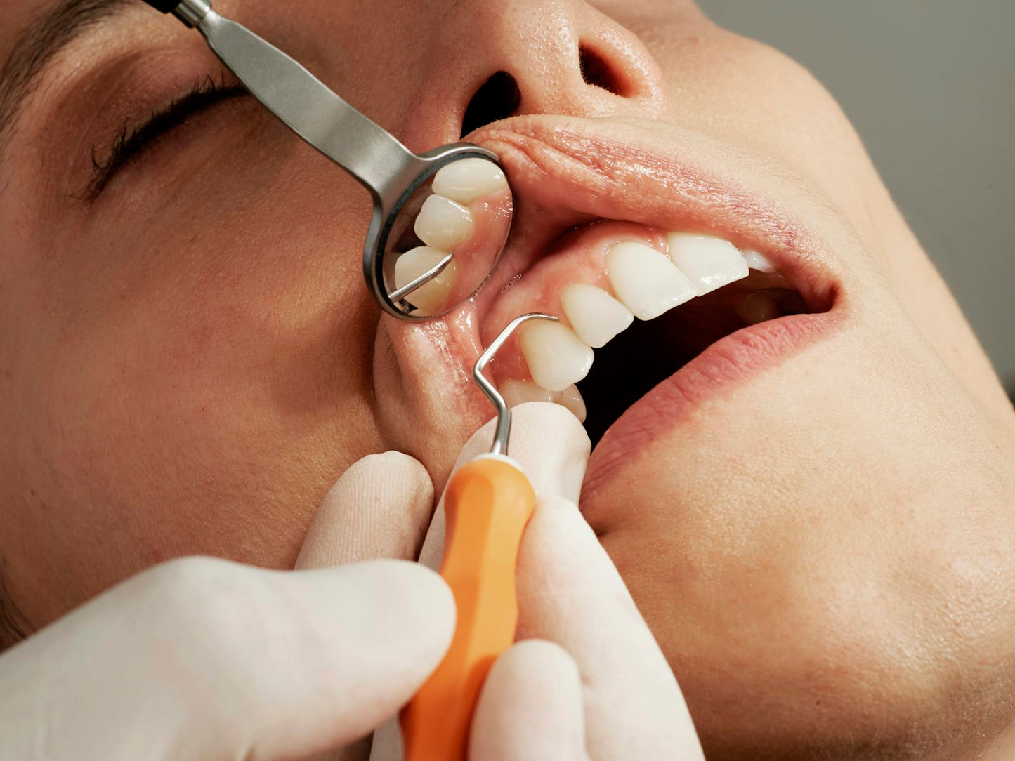 Dental examination – stock photo (Unsplash)