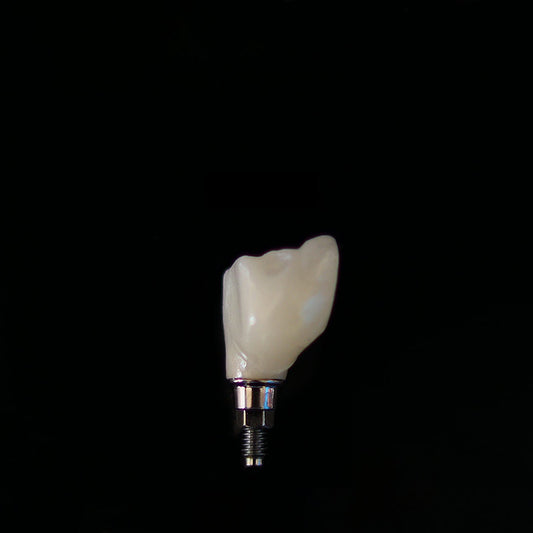 Tooth on dark background – stock photo (Unsplash)